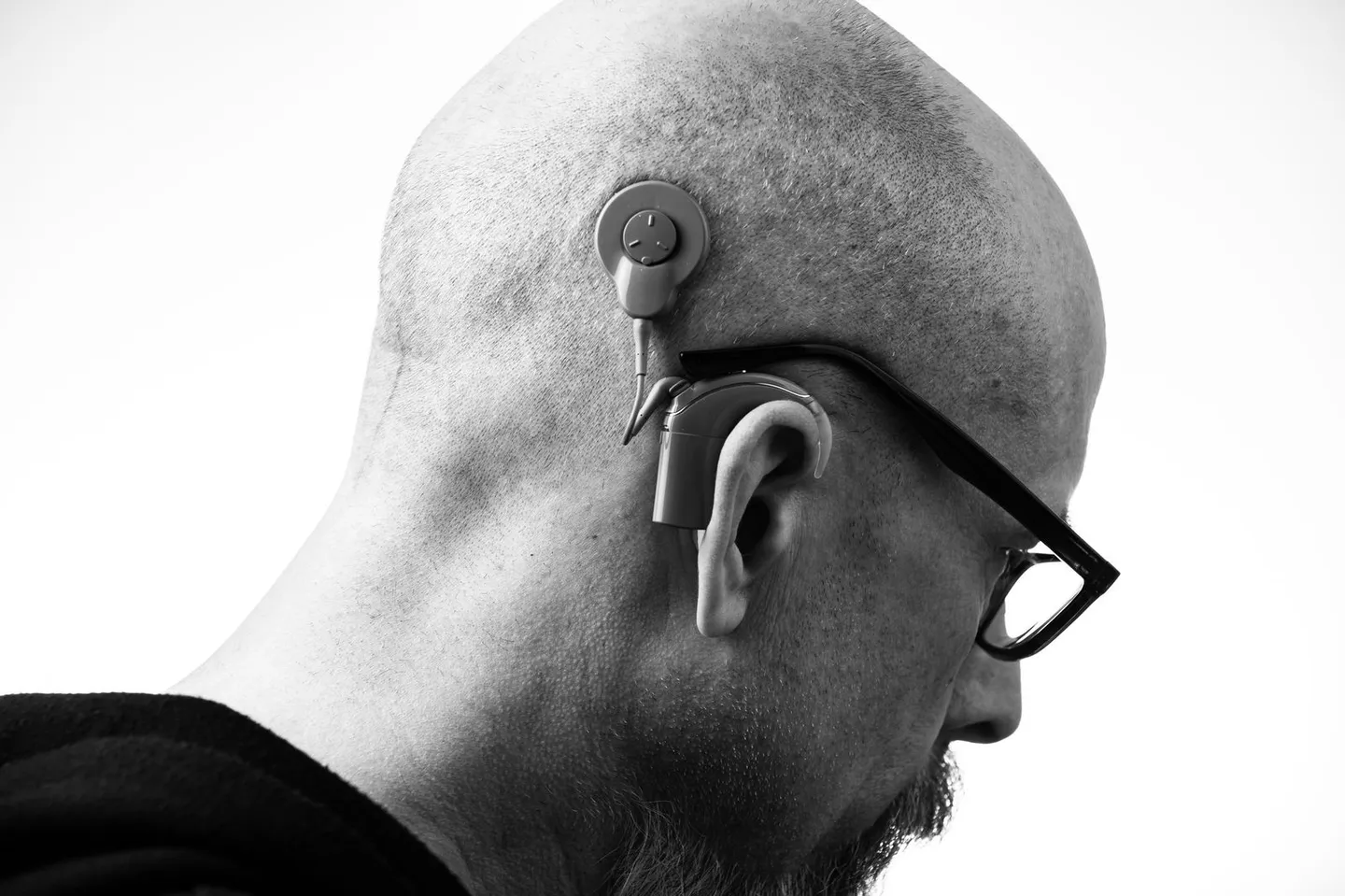 Seitenansicht eines Mannes mit Brille und einem Hörsystem hinter dem Ohr